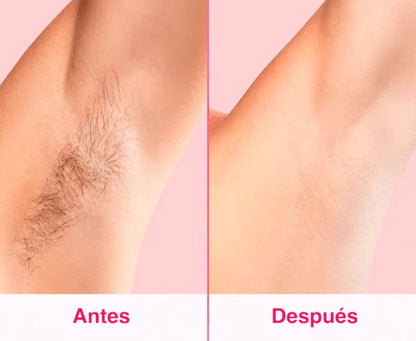 SkinUp | Depiladora a Laser